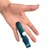 Изображение 4 Ортез-шина для пальца руки с фиксацией к ладони, металлическая TIANA Тип 503 размер S/5.0 - 6.0 см, Размер: 3