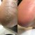Изображение 3 Спрей для стоп с мочевиной Nails Of The Day Podology+ Кератолитик, 100 мл