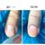 Изображение 6 Масло для ногтей и кожи Onistop Nails Of The Day (для лечения онихолизиса) 8 мл (S-ND), Объем (мл, г): 8