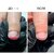 Изображение 4 Масло для ногтей и кожи Onistop Nails Of The Day (для лечения онихолизиса) 15 мл (S-ND), Объем (мл, г): 15