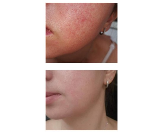 Изображение 4 Тоник для лица нормализирующий Eco.prof.cosmetics Normalizing Toner, 100 мл
