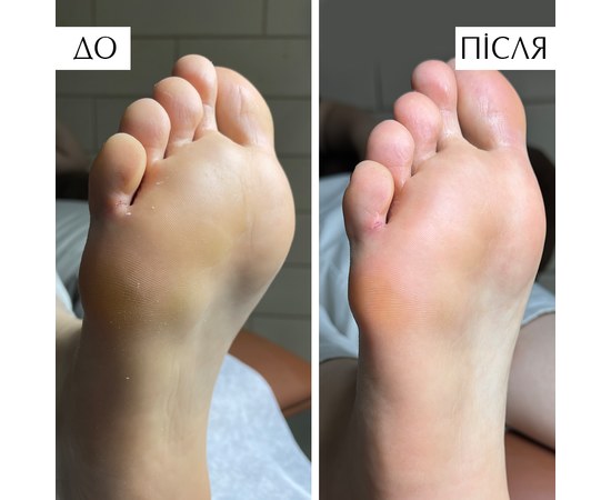 Зображення 3 Пінка для розм'якшення затверділої шкіри стоп PNB PedicureFoam, 150 мл