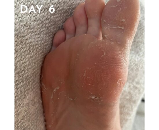 Изображение 6 hive Foot peel / Пілінг д/ніг - maskology 40 мл